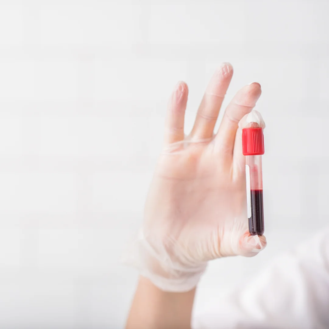 HSG Test